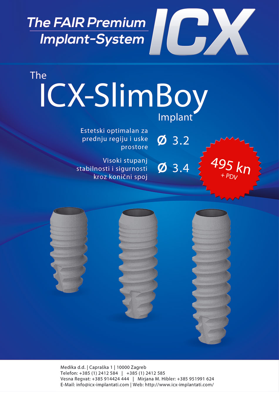 ICX Templant
